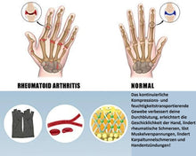 Lade das Bild in den Galerie-Viewer, MagicGloves - Die magische Handschuhe gegen Gelenkproblem
